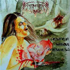 Postmorten - Cesarean Without Anesthesia