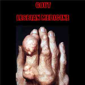 Gout  - Lesbian Medicine