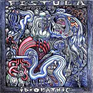 Fistula - Idiopathic