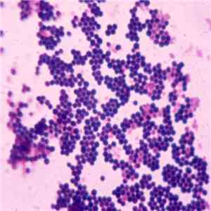 Sleep Column Bacteria - Staphylococcus Aureus