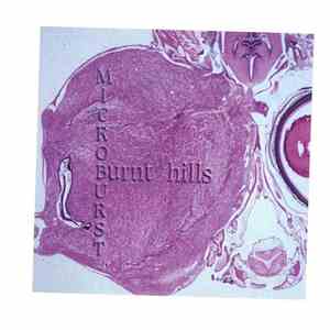 Burnt Hills - Microburst