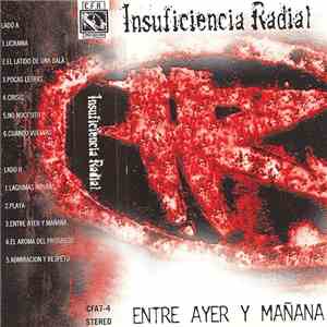 Insuficiencia Radial - Entre Ayer y Mañana
