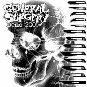 General Surgery - Demo 2005
