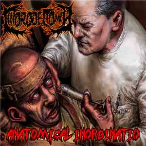 Clitorodectomía - Anatomical Inordinatio