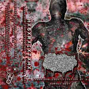 HxSxRxIxTxMx - Laborious Identification Of A Burned Body
