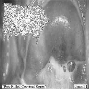 Infected Blistered Pissflap - Pus-Filled Cervical Sores