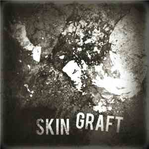 Skin Graft  - Skin Graft