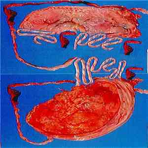 Streetmeat - Rebirth