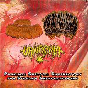 Fascitis Necrotizante, Urinaemia, Hypoprothrombinemia - Proximal Subtotal Gastrectomy For Stomach Adenocarcinoma