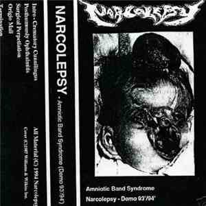 Narcolepsy - Amniotic Band Syndrome