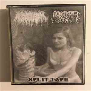 Agonizing Sepsis / Punctured Esophagus - Split Tape