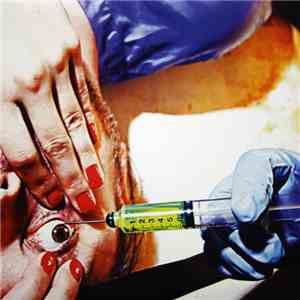 Racebannon - IV: Acid Or Blood