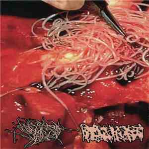 Digenetic Trematoda / Hydrocephalus  - Split