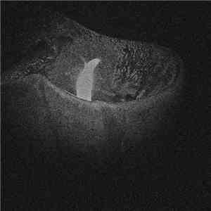 vax- - "The Black Book"