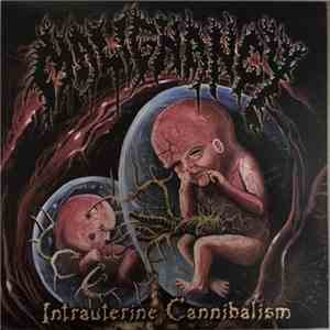 Malignancy - Intrauterine Cannibalism